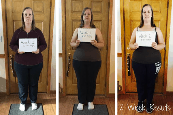 results gastric diet sleeve liquid week op weeks protein lose doctor appointment another lbs bloggingmomof4