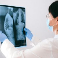 A Doctor Holding an X-ray Result